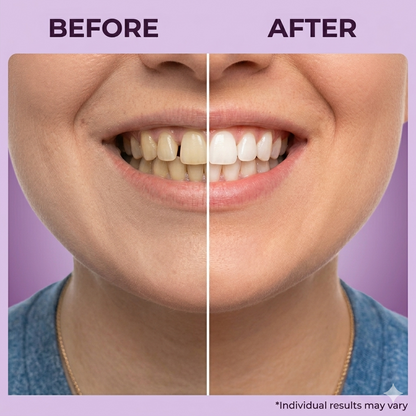 NALIXORA WHITENING STRIPS