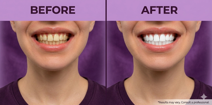 NALIXORA WHITENING STRIPS