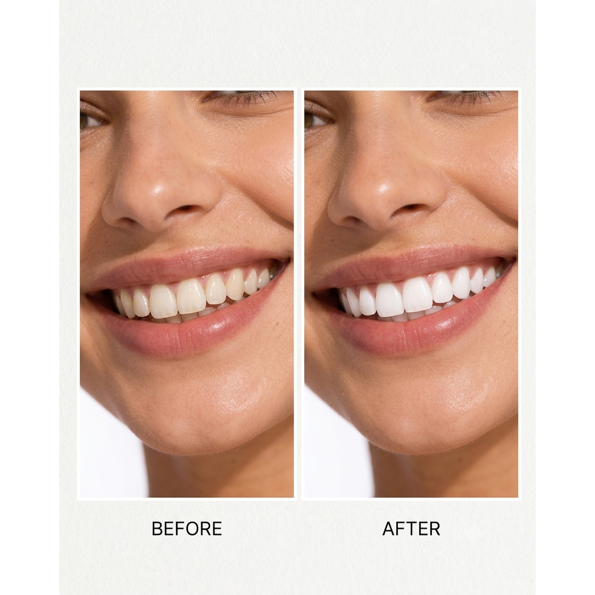 NALIXORA Whitening Strips